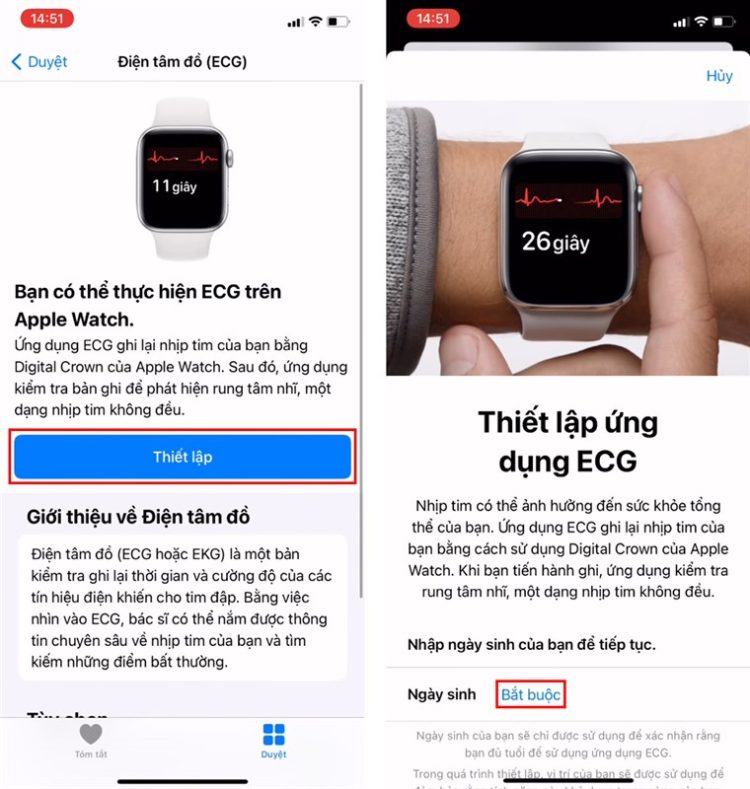 Cách sử dụng tính năng ECG trên Apple Watch 2