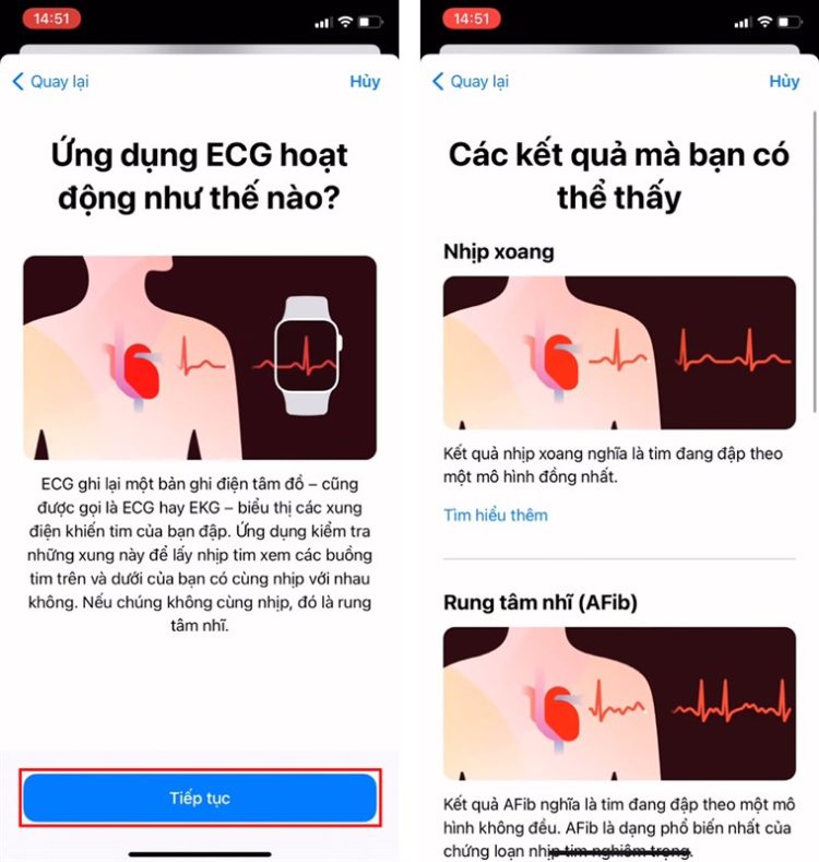 Cách sử dụng tính năng ECG trên Apple Watch 3