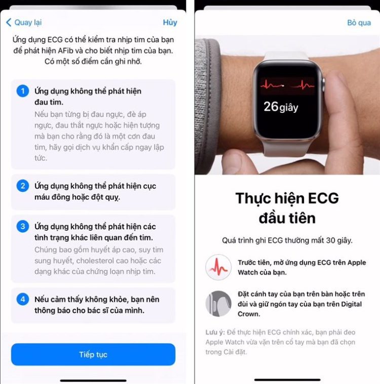 Cách sử dụng tính năng ECG trên Apple Watch 4