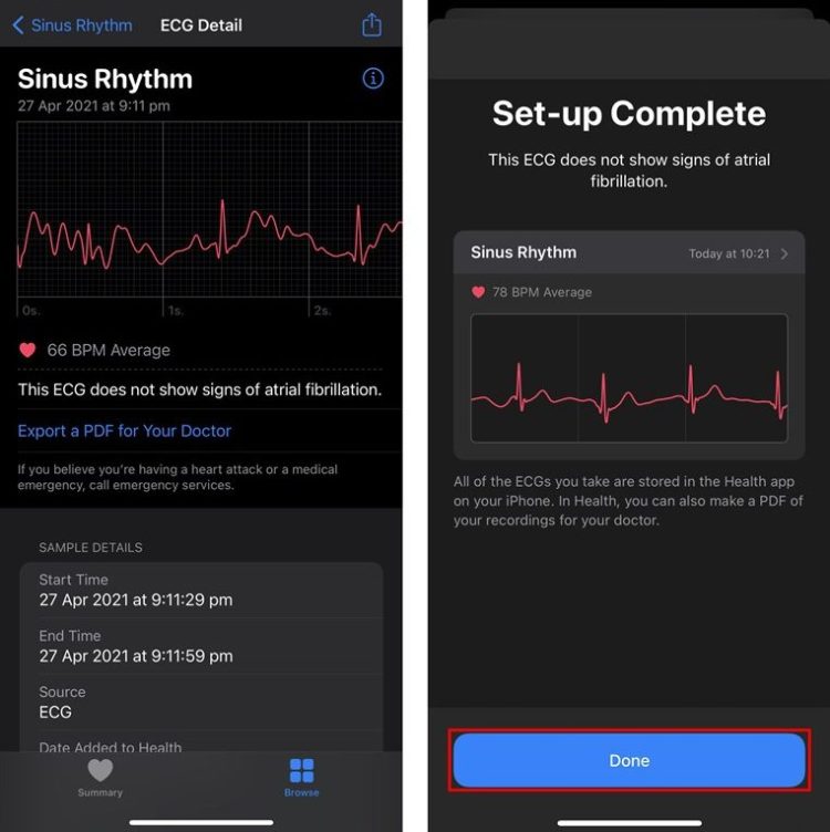 Cách sử dụng tính năng ECG trên Apple Watch 6