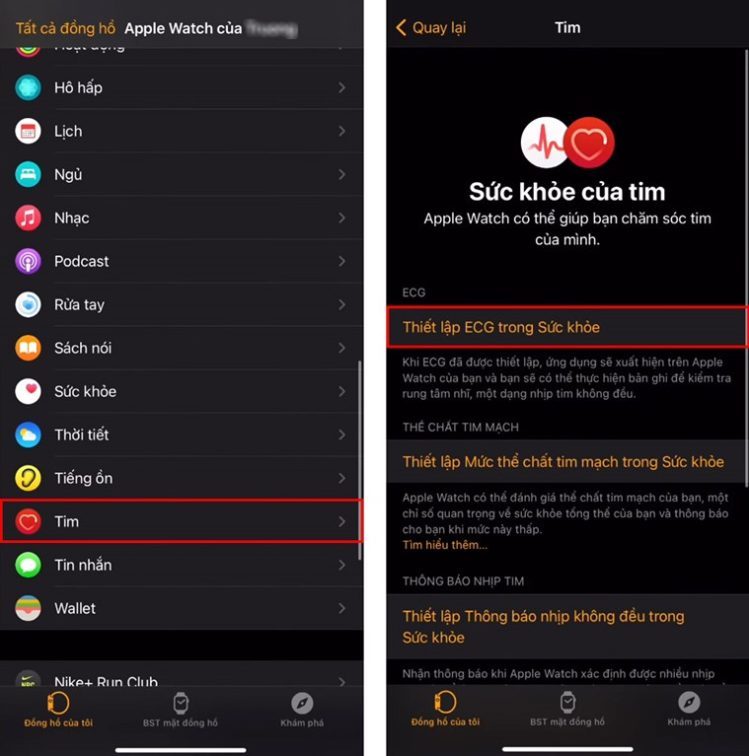 Cách sử dụng tính năng ECG trên Apple Watch
